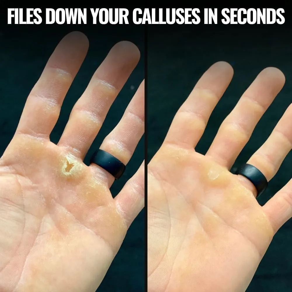 Callus Remover & File - Lightweight Hand Callus Tool - Perfect for Cross Training, Gymnasts, Rock Climbers & Gym Athletes - Easy Clean Hand Care Tool - Maintain Calluses